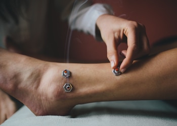 caitlin gordon boulder acupuncturist performing moxibustion