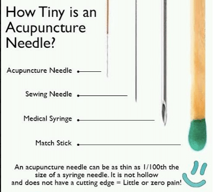 Acupuncture Needle Size