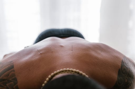 7 Best Boulder Acupuncture Clinics